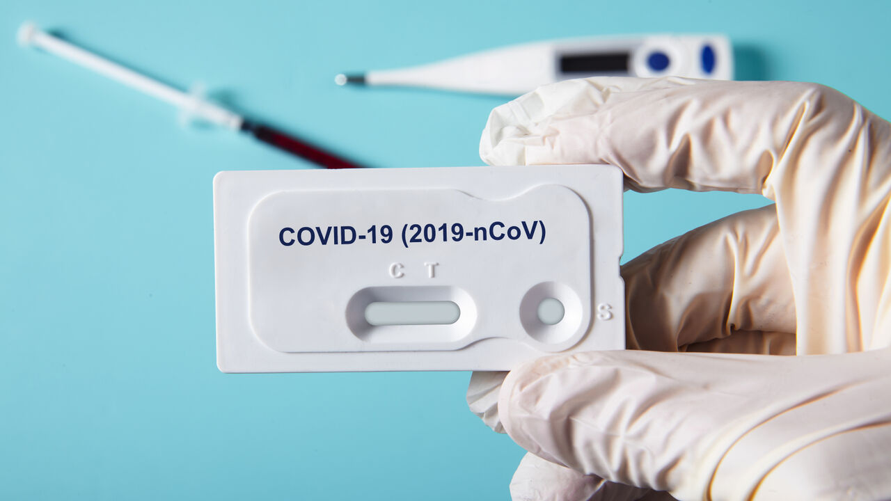 انجام بیش از ۹۳۰۰ تست تشخیص کووید۱۹ در ۲۴ ساعت گذشته
