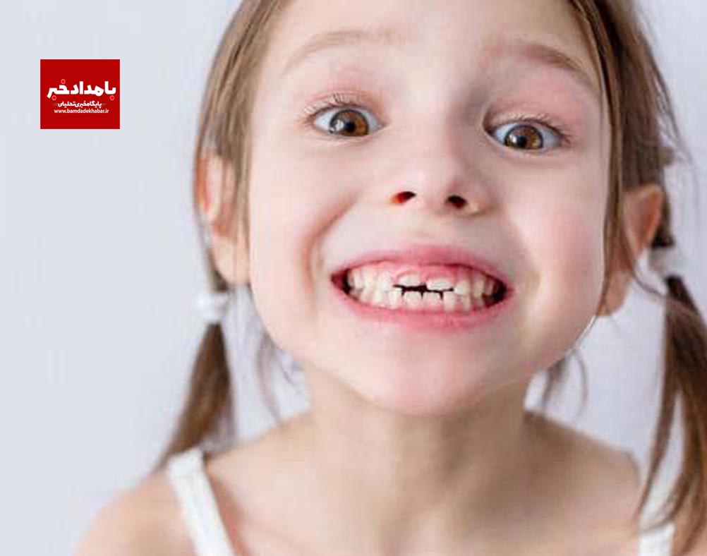چگونه از پوسیدگی دندان در کودکان پیشگیری کنیم؟